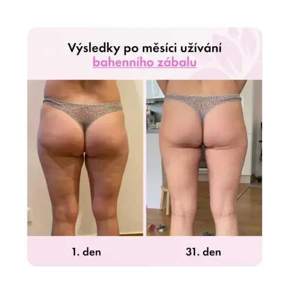 Bahenný zábal Guam FIR na brucho a pás - Image 3